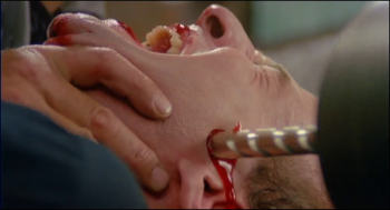 [Kép: 0b2487235893598.jpg]